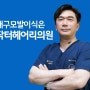 대구 모발이식 병원 탈모 원인과 유형별 대응 방안