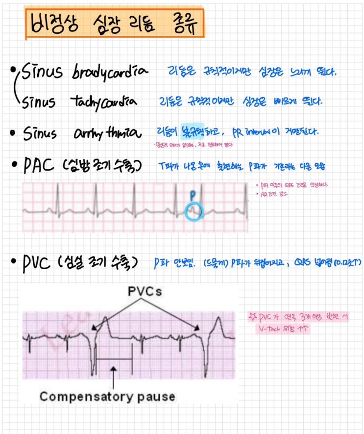Ekg v tach v fib pea psvt 
