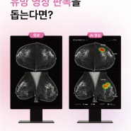 [박희붕외과] 유방암 진단을 위한 AI 영상 분석 솔루션 '루닛 인사이트 MMG' 도입