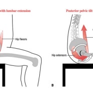 [상현동PT] 골반전방경사 장시간 앉아 있는 사무직 직장인 필수 지식 !