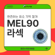 유성안과 부작용 없는 MEL90 라섹수술