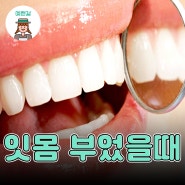 잇몸 부었을때 치과 가기 전 알아 둘 것