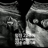 [임신 22주차]수지미래산부인과 정밀초음파/부분 전치태반/증상기록