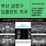 부산 금정구 임플란트 전문 잘하는치과