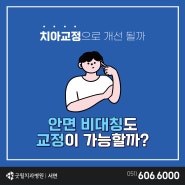 부산서면교정치과 안면비대칭도 교정으로 고칠 수 있나요?