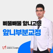 삐뚤빼뚤한 앞니 고민!!