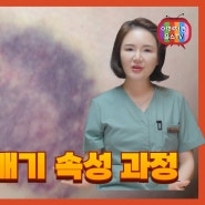 여의도 유스피부과 멍 붓기 빨리 빼는 법, 찜질, 마사지, 수술, 시술 후 생긴 멍과 부기 부종 빼기