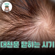 대천문 닫히는 시기 신생아 주의사항