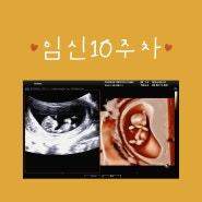 10주차 초음파 활발한 아기 움직임. 태아 크기. 신기방기