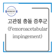 [퇴행성골관절염, 관절순파열, 송도재활PT] 고관절충돌증후군(FAI)