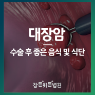 대장암 수술 후 좋은 음식 및 식단