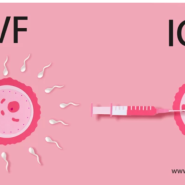 [영국 난임 일기] #6 IVF 스케쥴 정리