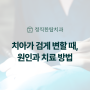 판교 정자동치아미백, 신경이 죽은 치아가 검게 변했어요 이빨 변색 시 실활치 미백 치료