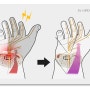 골퍼와 주부들의 고질병 수근관증후군