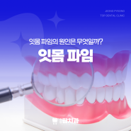 잇몸파임 원인, 치과에 가야 될까?