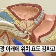 남자 전립선 질환 종류 및 관리 방법 알아봐요