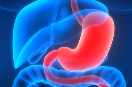 Upper GI problems GERD, Refeeding syndrome, Dumping syndrome : 네이버 블로그