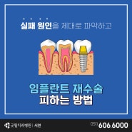 부산임플란트재수술 실패원인을 제대로 파악해야