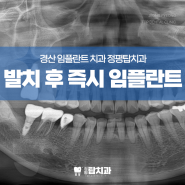 경산 발치후 임플란트 신경치료 및 크라운, 치경부 레진 치료