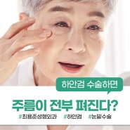 대구눈밑수술 하안검 하면 주름이 전부 펴질까?