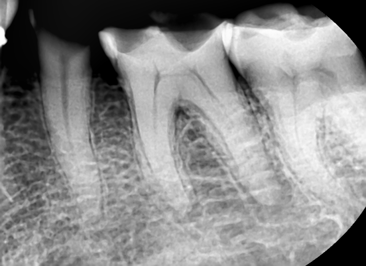 임상기록 9 - #35, 36 RCT : 네이버 블로그