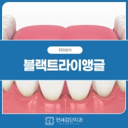 블랙트라이앵글 치료가 가능하나요?