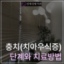 충치의 단계와 치료방법 (치아우식증) - 연세정원치과의원