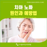 치아 노화 원인과 예방법 알아둬요