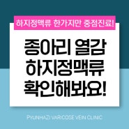 원주하지정맥 종아리 열감을 유발할 가능성은