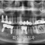 임플란트 - 목포확실한강치과