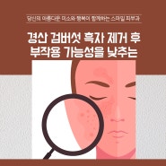 경산 검버섯 흑자 제거 후 부작용 가능성을 낮추는