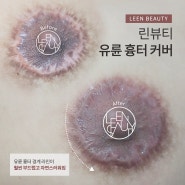 남자유륜문신 여유증 흉터 감쪽같은 개선 (유륜반영구 이벤트)