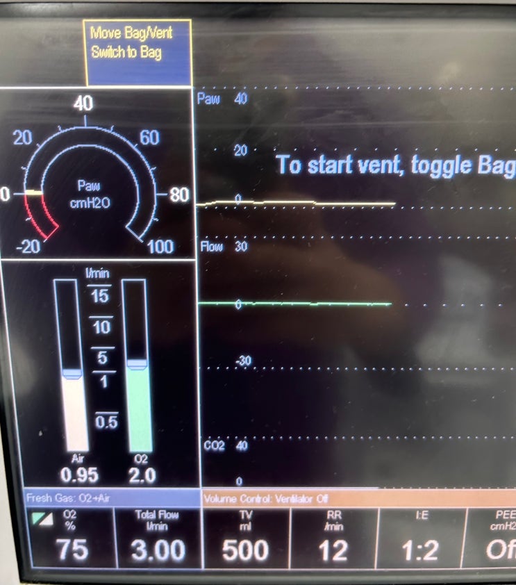Ventilator 적용 중 Fio2 계산법 : 네이버 블로그