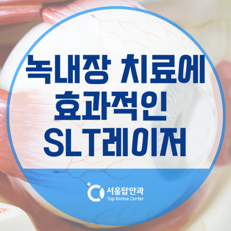 청주 오송 안과, 녹내장 치료에 효과적인 SLT 레이저란? : 네이버 블로그