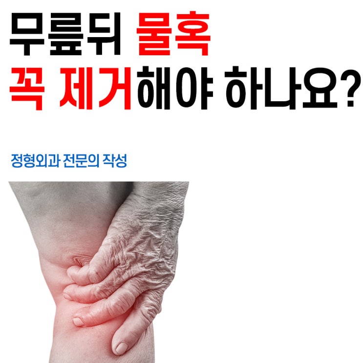 무릎뒤 물혹(베이커낭종) 꼭 제거해야 하나? (주사, 수술) : 네이버 블로그
