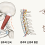 50대 여성, 목 디스크 진단 후 끝임 없이 저리고 통증이 있는 엄지와 검지! 정말 안 낫는 목 디스크 해결하고 싶은 신분만 보세요.