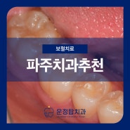 파주치과추천 치외치때문에 치아가 너무 아파요