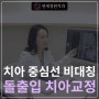 치아 중심선 비대칭 및 돌출입 교정 @ 대치동 교정치과 연세정원치과