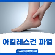 대구정형외과추천 아킬레스건 파열 수술과 재활치료는