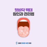 혓바닥 백태 원인과 관리방법