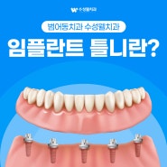 범어동치과 수성웰치과 임플란트 틀니란?