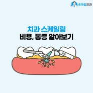 스케일링 비용, 통증 등 정보 알려드려요