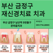 부산 재신경치료, 충치치료 치과