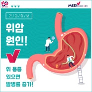 위 용종 있으면 위암 발병률 증가! 위내시경 조직검사