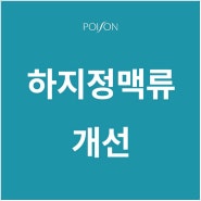 하지정맥류개선 다양한 원인과 예방 전략