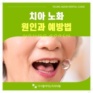 치아 노화 원인과 예방법 알고싶다면