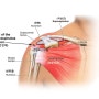 오십견(유착성 관절낭염), 회전근개파열 증상과 치료