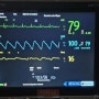 병원 환자 모니터 보는 방법 (HR, SpO2, RR, DBP, SBP, Afib)