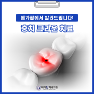 [안양 치과]치아 건강의 비밀: 크라운 치료의 모든 것