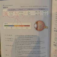 개안해서 돌아온~~👀 내돈내산 강남/신논현 고도근시 시력교정 검안후기 겸 스마일라식 후기🏥